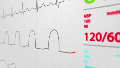 animation of schematic intensive care unit monitor showing normal values for vital signs, starting with cardiac frequency. dark blue backgound. perfect for any medical-related purposes.