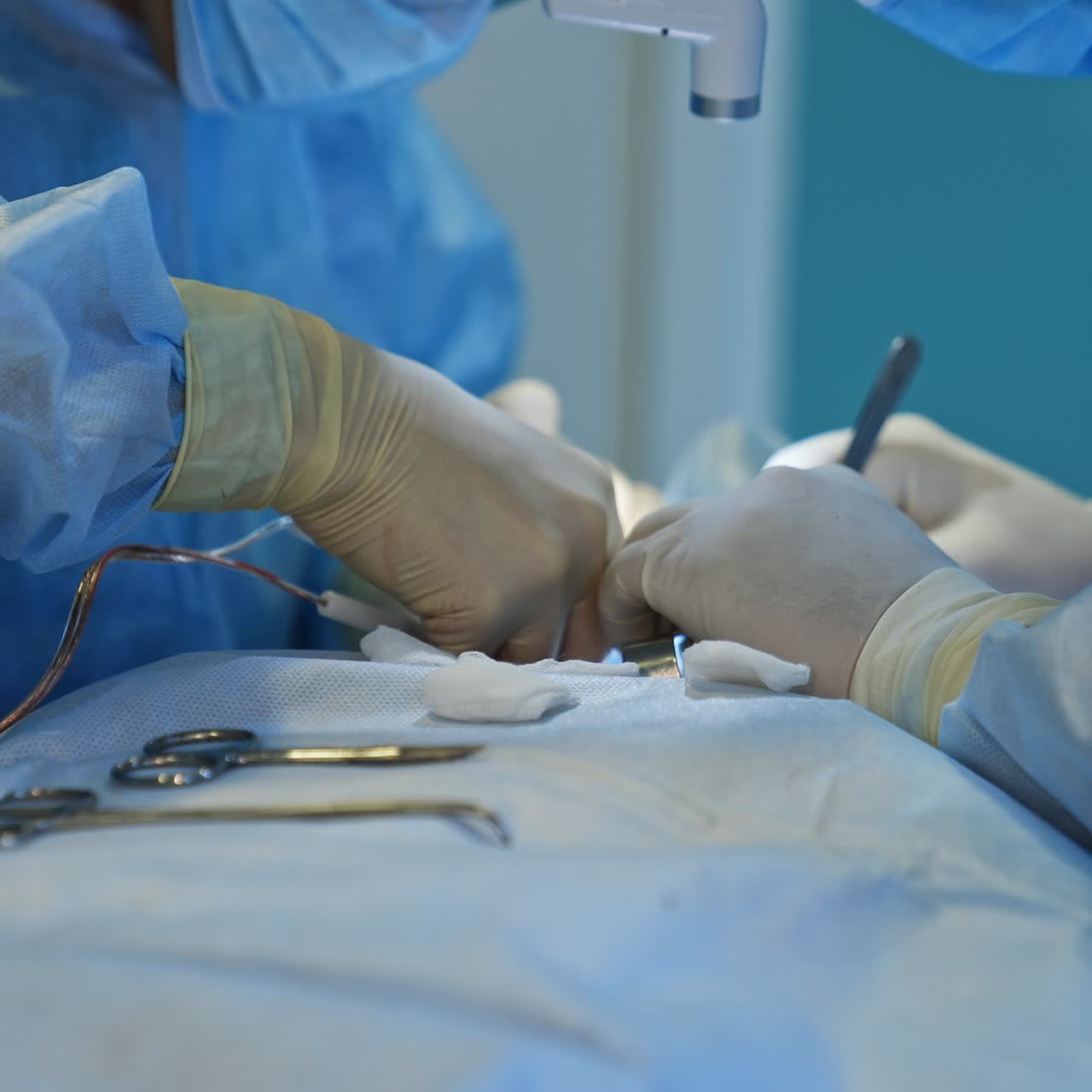 Operating surgeons stand on both side of the patient conducting surgery. Doctors' hands in gloves apply electric device and metal tools. Nurse's hand putting instruments on the patient closer to surgeon's reach