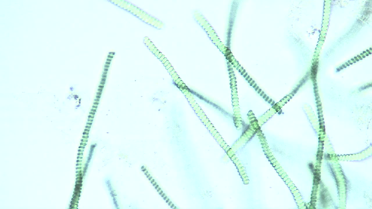 스피루리나 sp 남조류 1의 현미경 사진