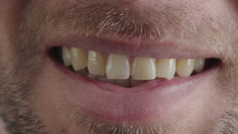 Nahaufnahme-Eines-Kaukasischen-Mannes-Mit-Lächelndem-Mund-Und-Zähnen,-Junger-Mann-Mit-Gesichtsbehaarung