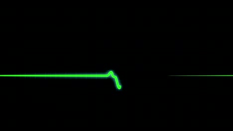 gráfico verde del ritmo cardíaco en la pantalla médica