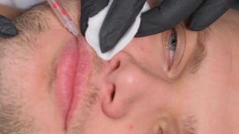 man getting lip filler procedure