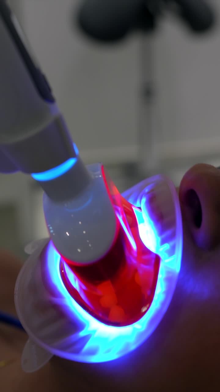 Teeth whitening treatment using dental equipment