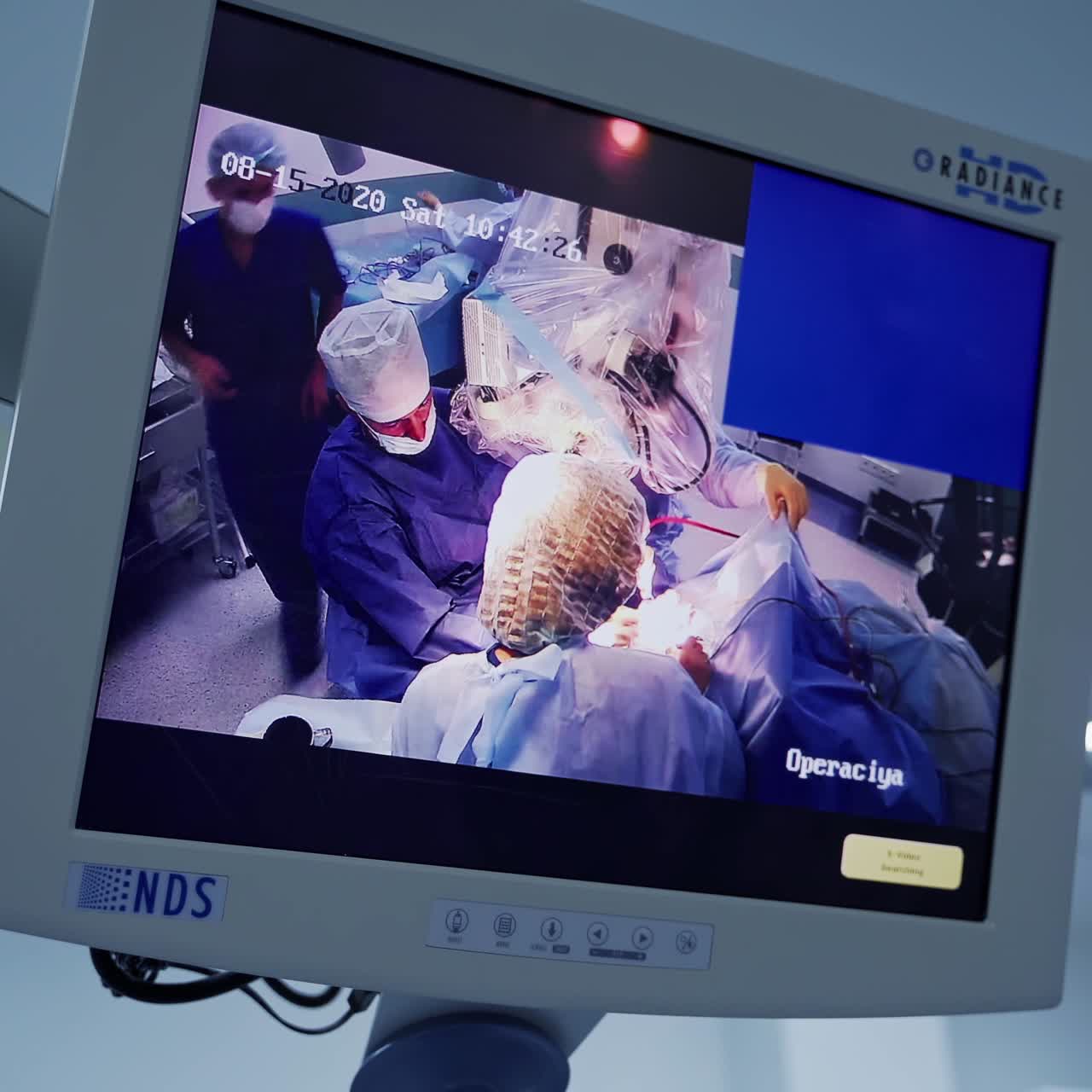 Medical monitors in the operating room. Teamwork of surgeons on the screen. Internal organs on a display during surgery.