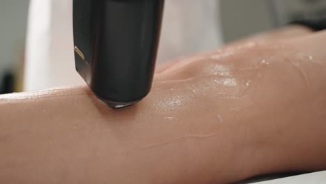 close-up view of laser hair removal on a woman's leg, technician applying the treatment