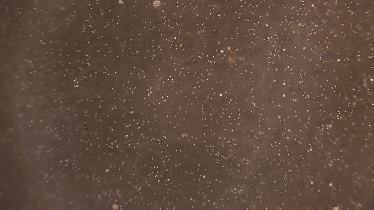 수많은 미세한 정자 세포가 정액에서 헤엄치고 있습니다.