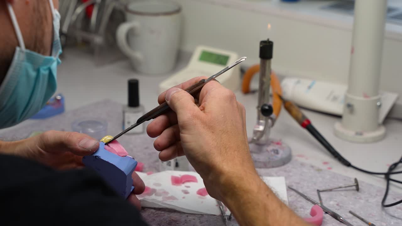 técnico dental que derrite cera para mandíbula artificial en prótesis dentales y hace dientes nuevos en el taller en una pequeña clínica