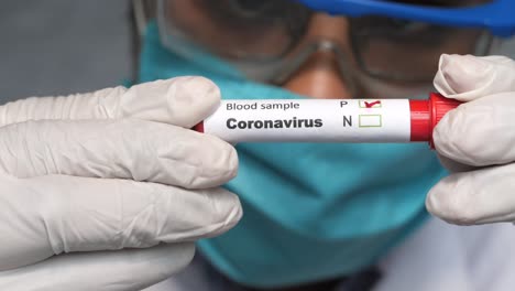 coronavirus blood sample testing