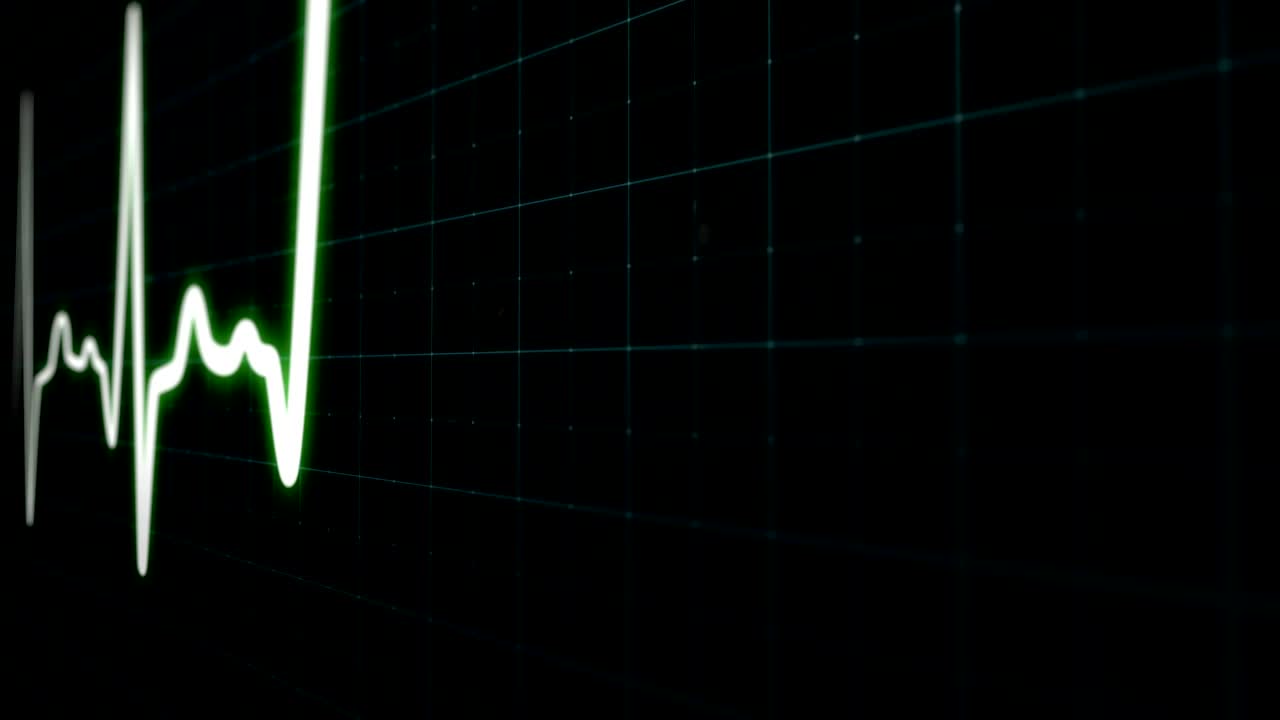 monitor de ritmo cardíaco electrocardiograma monitor médico