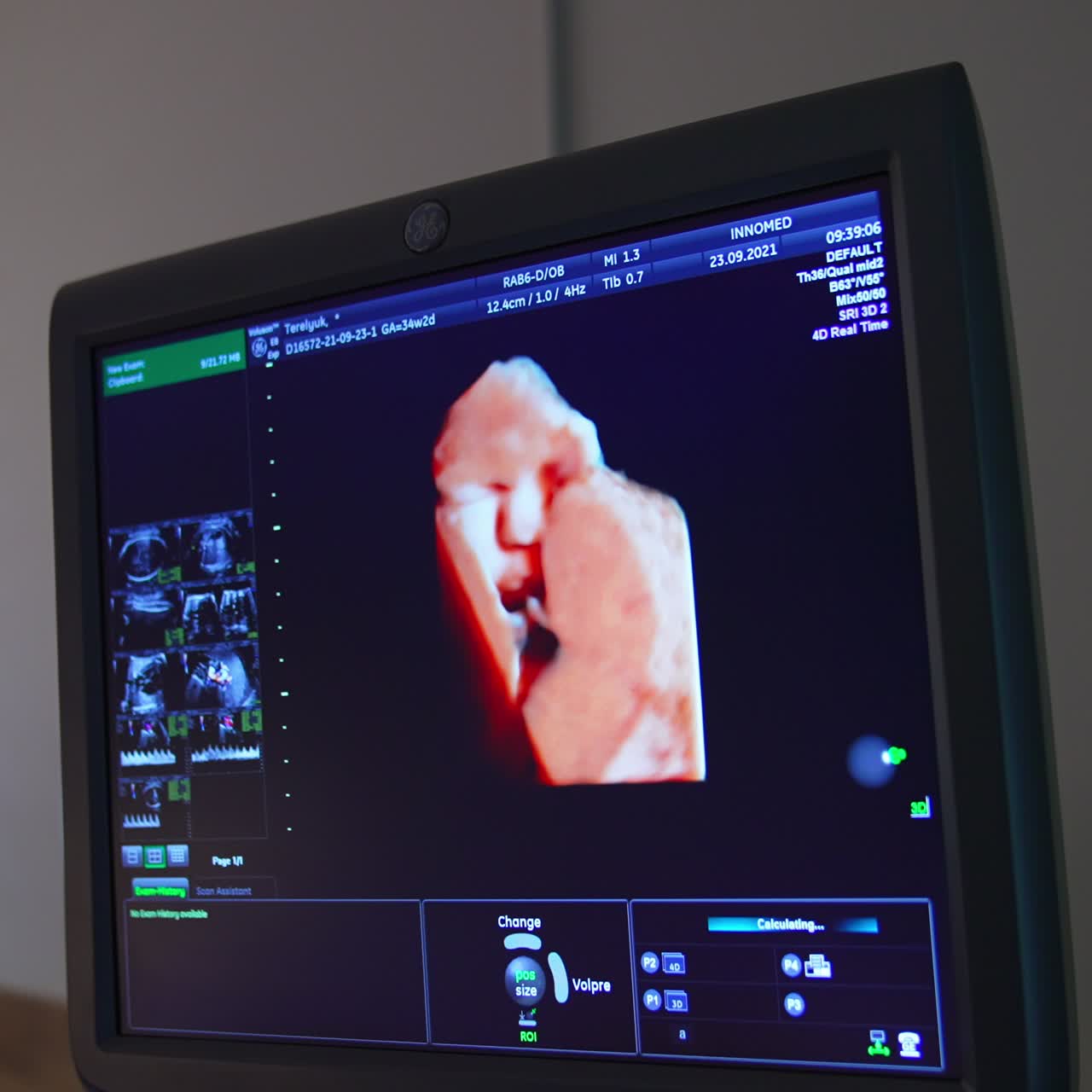 Bebè visto sullo schermo di un apparecchio per ecografie. Primo piano. Ecografia di controllo di una donna incinta