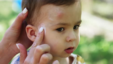 lovely dark-eyed caucasian boy stands still while mother applies ointment on his face. mom helping her baby to relief itch from mosquito bites. close up.