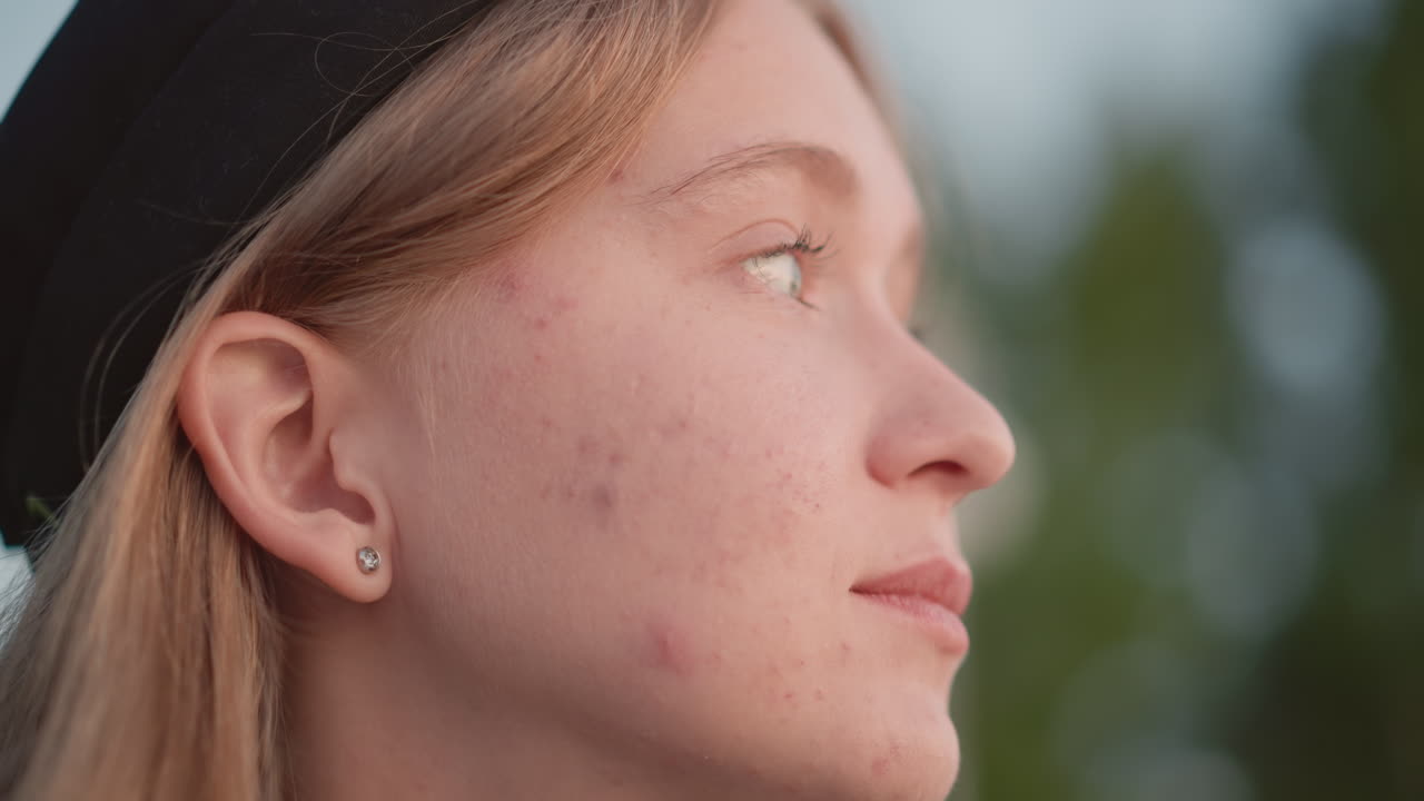Primer plano de una mujer blanca y reflexiva mirando hacia arriba, pecas visibles sobre un suave fondo natural, momento de introspección y esperanza, sonrisa sutil y mandíbula relajada, luz solar tenue