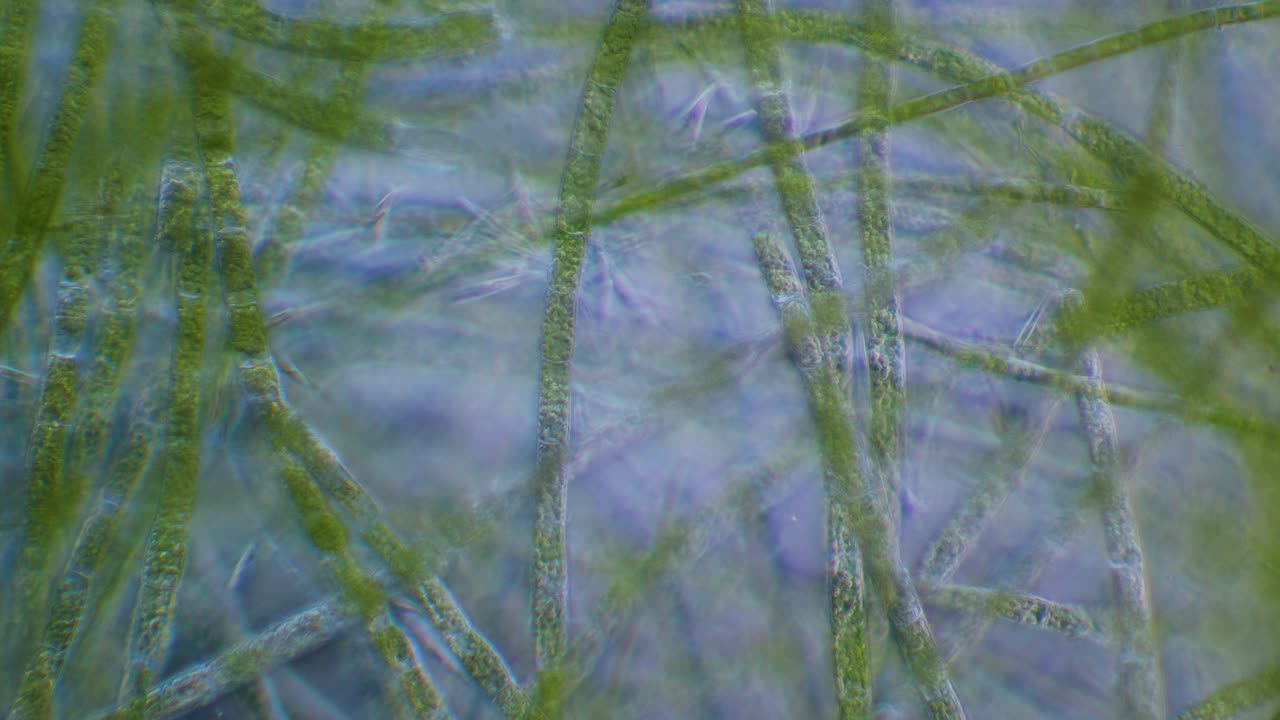 Filamentous green algae under microscope