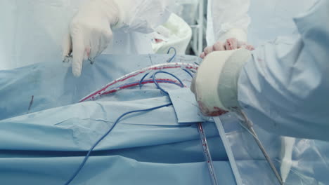 medics prepare chest tubes for surgery. experienced surgical team quickly tunes equipment for removing air and drain fluid from cavity in clinic