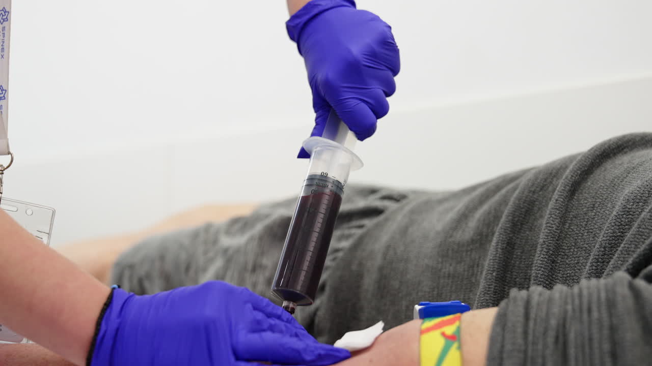 Large syringe is being filled with blood. A nurse takes blood sample form the patient. Close up.