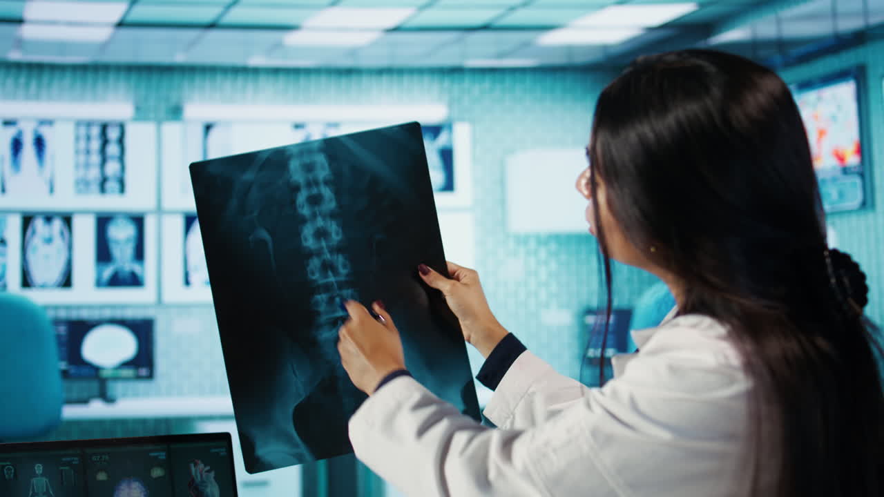 Doctor examining spine x-ray in medical office