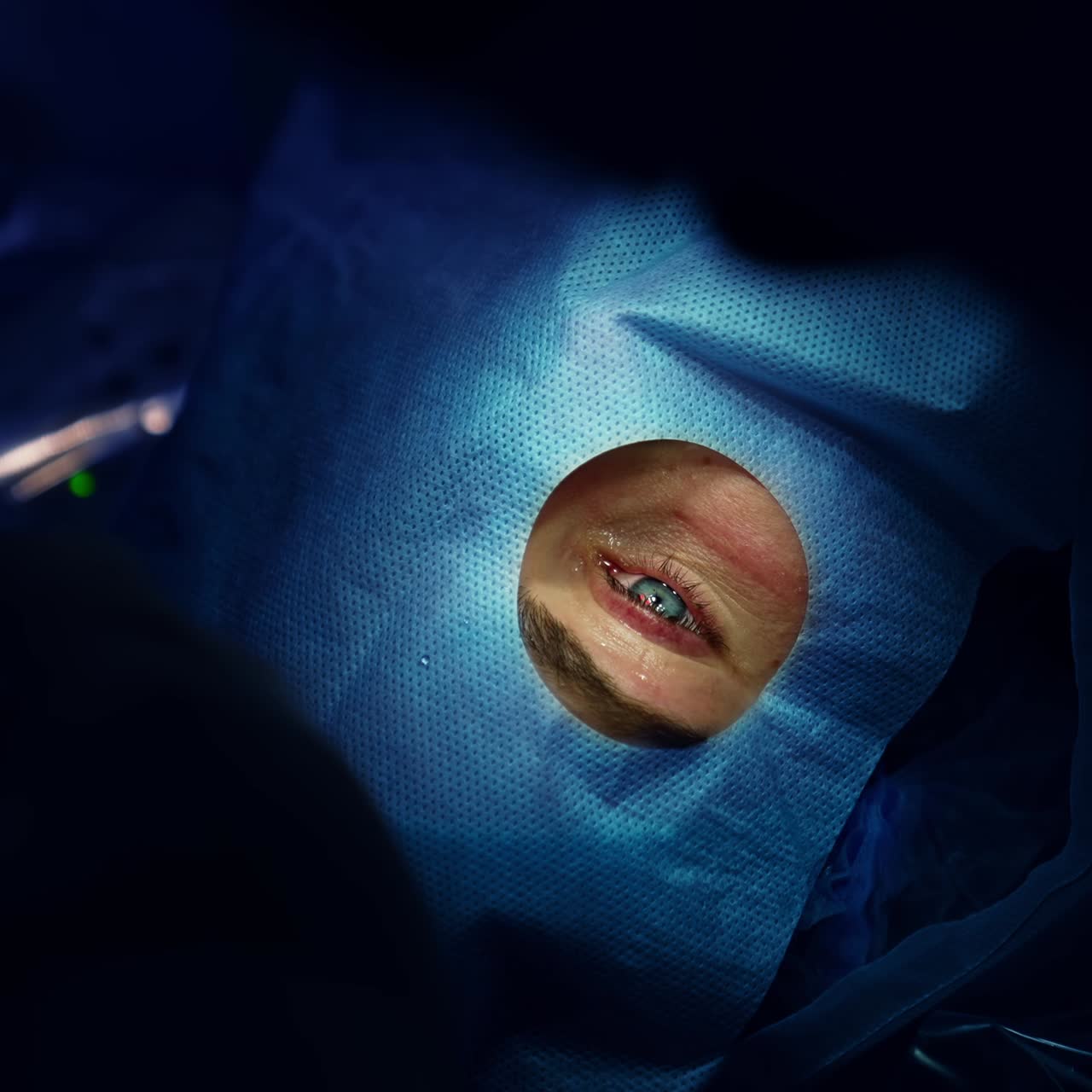 Modern medicinsk laserögonkorrigering. Ny sjukvårdskirurgi för grå starr