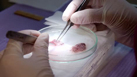 cell culture of single hair follicles for transplantation being prepared in a petri dish using forceps, medical instruments