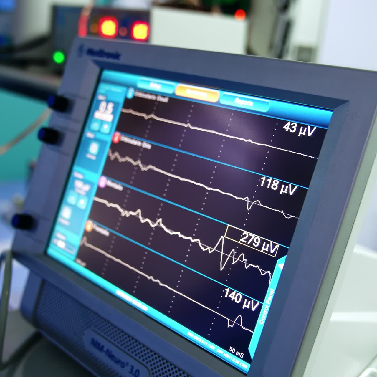 Linee curve che scorrono rapidamente sullo schermo del monitor neurologico. Vista ravvicinata dell'attrezzatura nella sala operatoria.