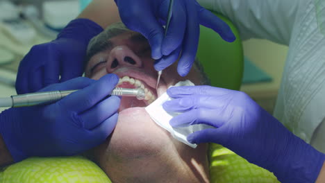 treatment of toothache in dentist office. close up dentist drilling sick tooth