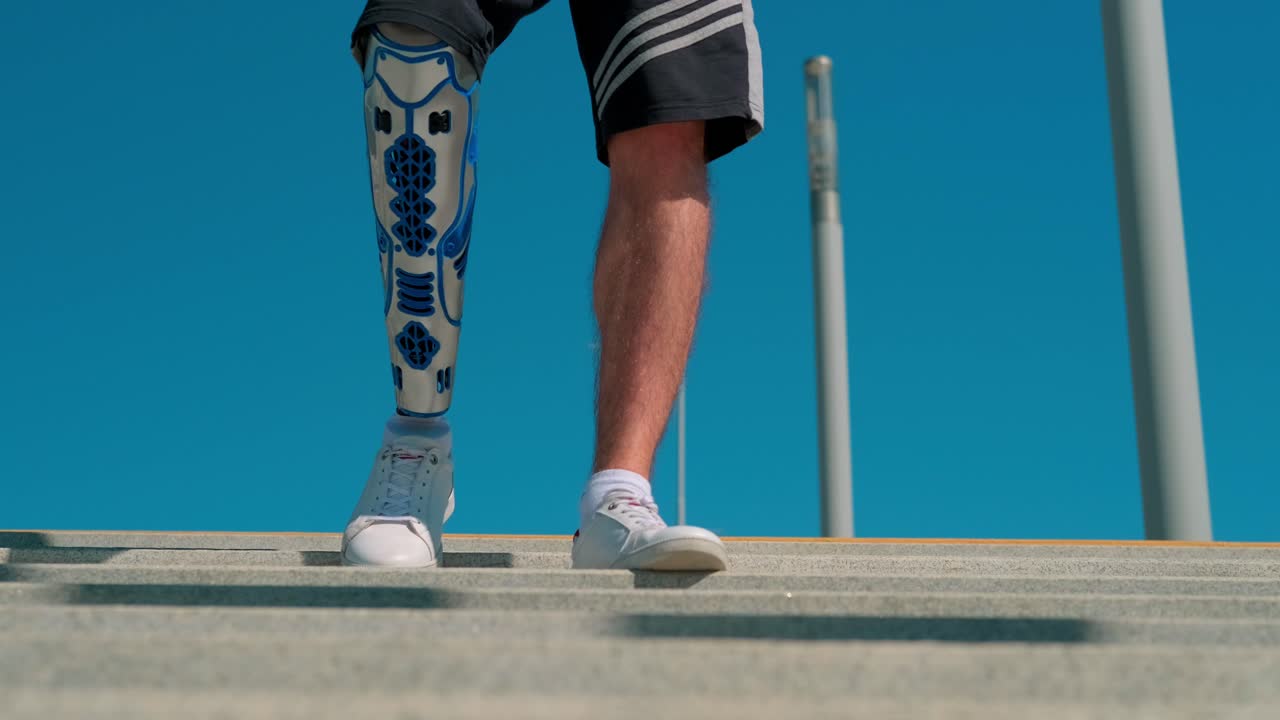 의수 다리를 가진 사람이 위층을 고 있습니다.