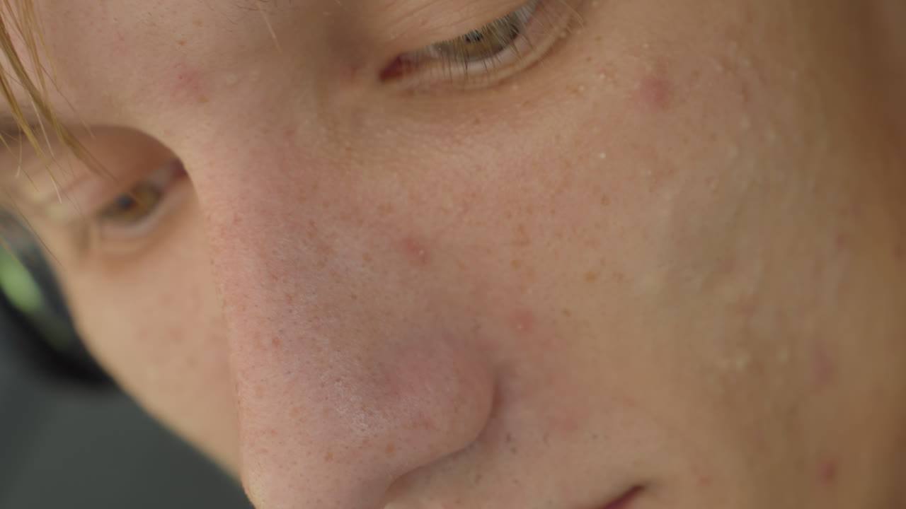 primo piano del volto di un giovane uomo bianco che mostra la grana dell'acne, i pori e una leggera barba incolta, sguardo basso, movimento timido delle labbra, espressione pensierosa, luce naturale soffusa, sfondo urbano con accenno di cuffie
