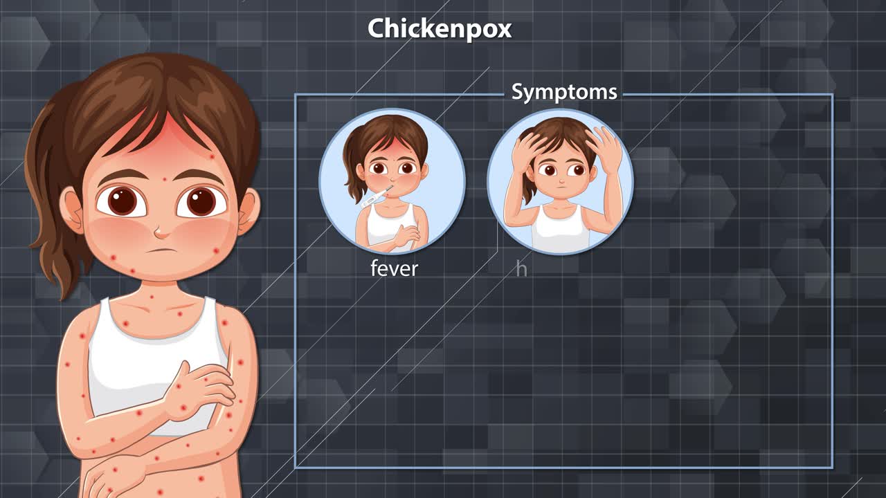 Animated sequence illustrating chickenpox symptoms in a girl, with labeled icons and gradual symptom reveal