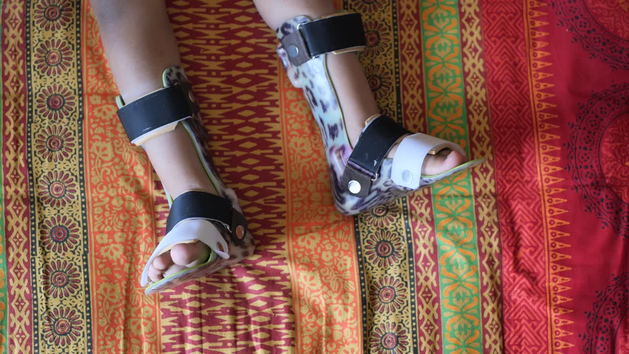 niño con aparatos ortopédicos para las piernas