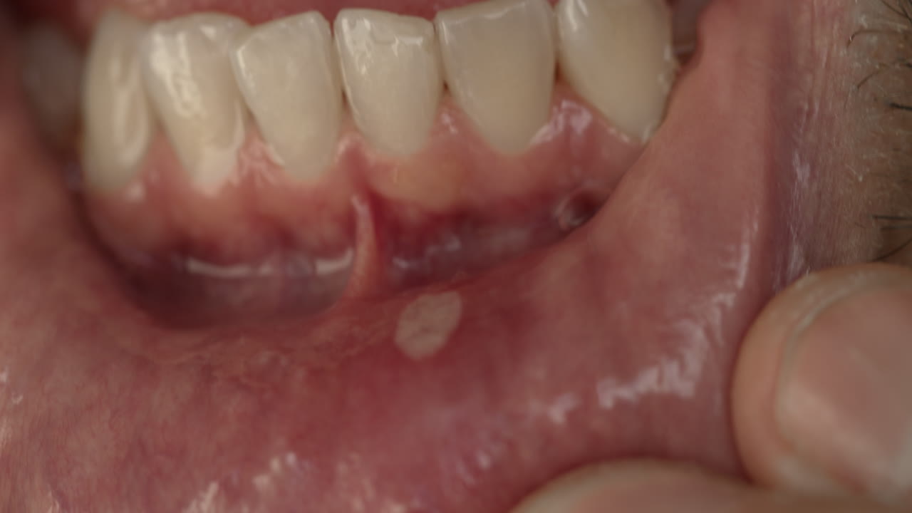 fotografía de cerca de la boca de un macho joven con barba