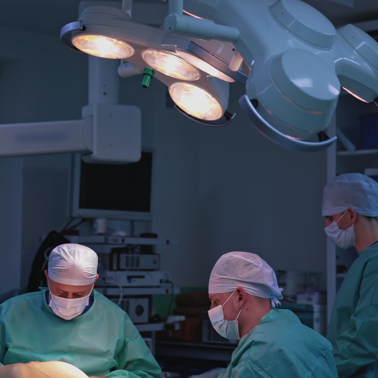 Et hold kirurger udfører et kirurgisk indgreb på en operationsstue. En gruppe læger udfører plastikkirurgi på en patient under den medicinske lampe på hospitalet.