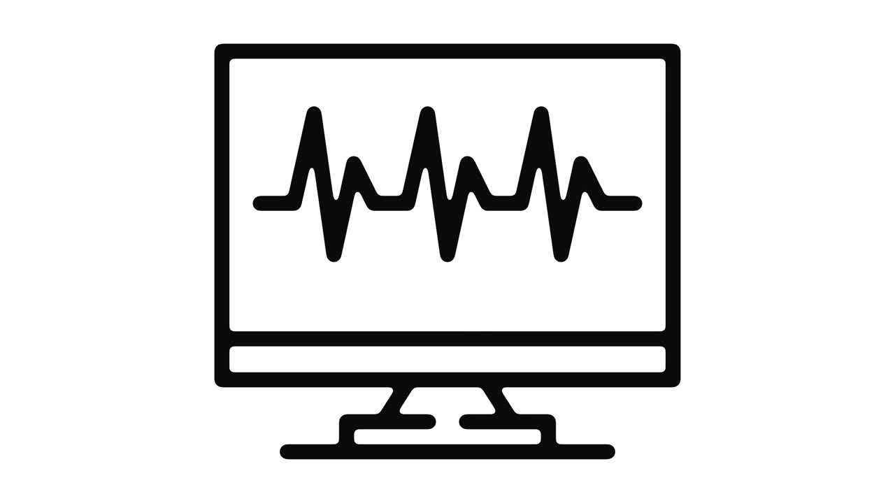 gráfico de seguimiento del movimiento de la línea