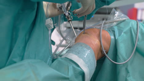 two surgeons performing knee arthroscopy surgery using various instruments to remotely cut silk thread fixing problems inside joint - close-up