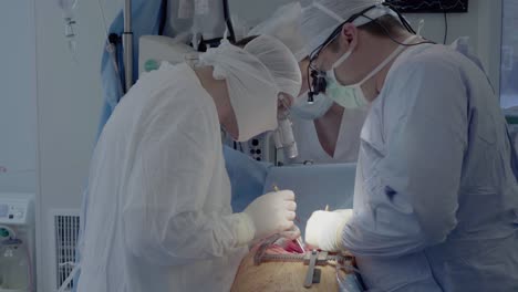 medical staff of the operating unit do heart surgery