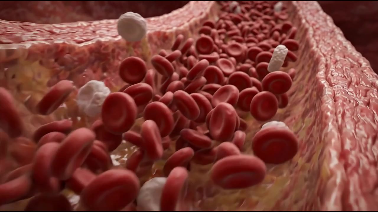 Animazione medica 3D dello stomaco che mostra l'artrite