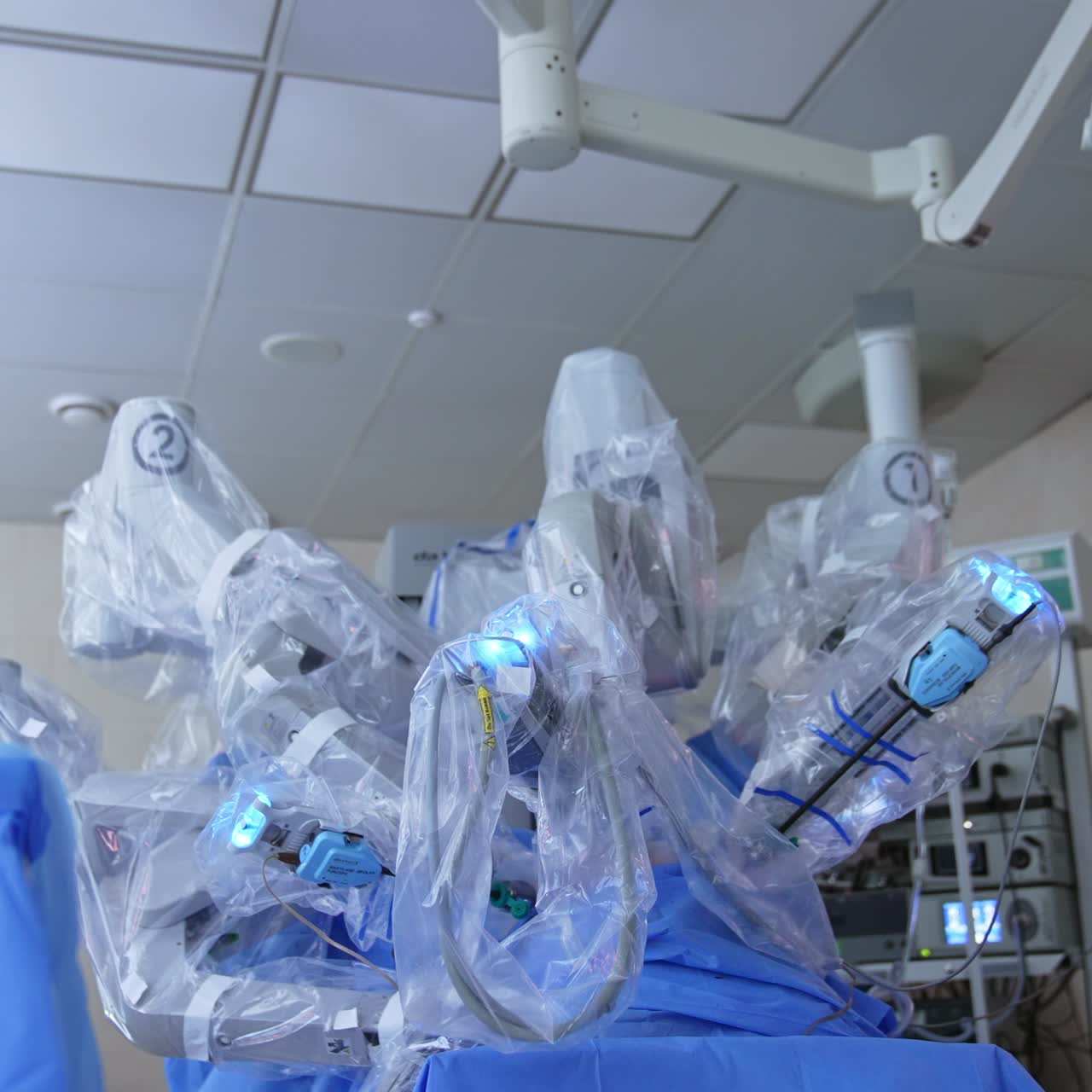 Multiple robotic arms of Da Vinci equipment move over the patient. Screen above shows the process of operation inside the organ