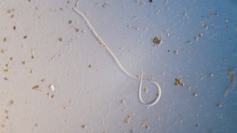 gusano parásito nematodo en microscopio campo brillante