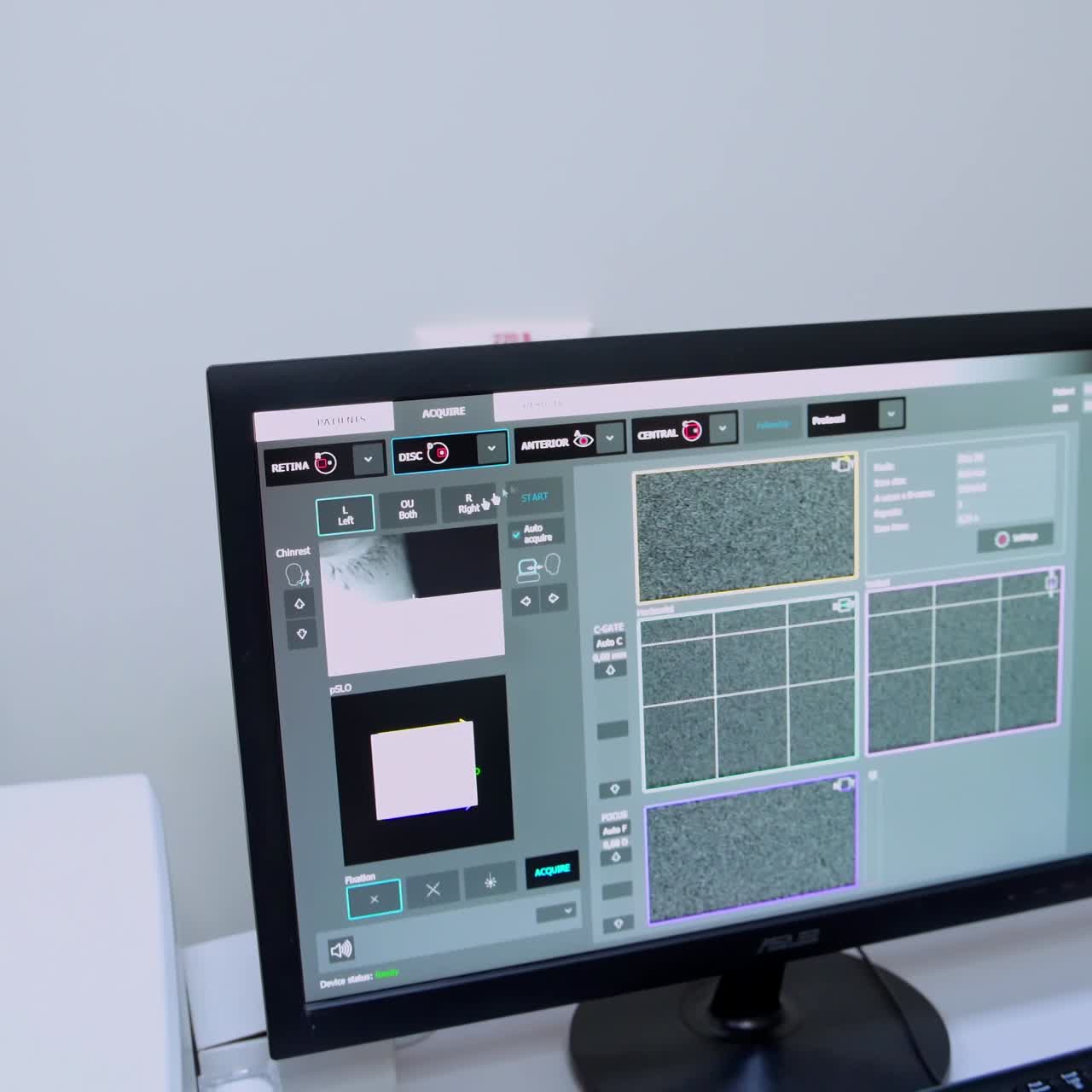 Patient checking vision