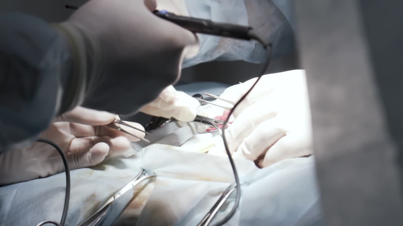 진행 중인 수술 절차