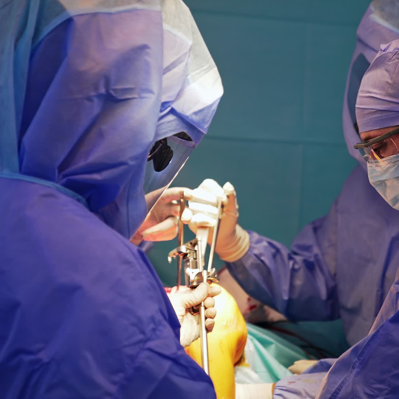 Large surgical team performing knee operation. Doctors in protective suits hold the metal medical tools