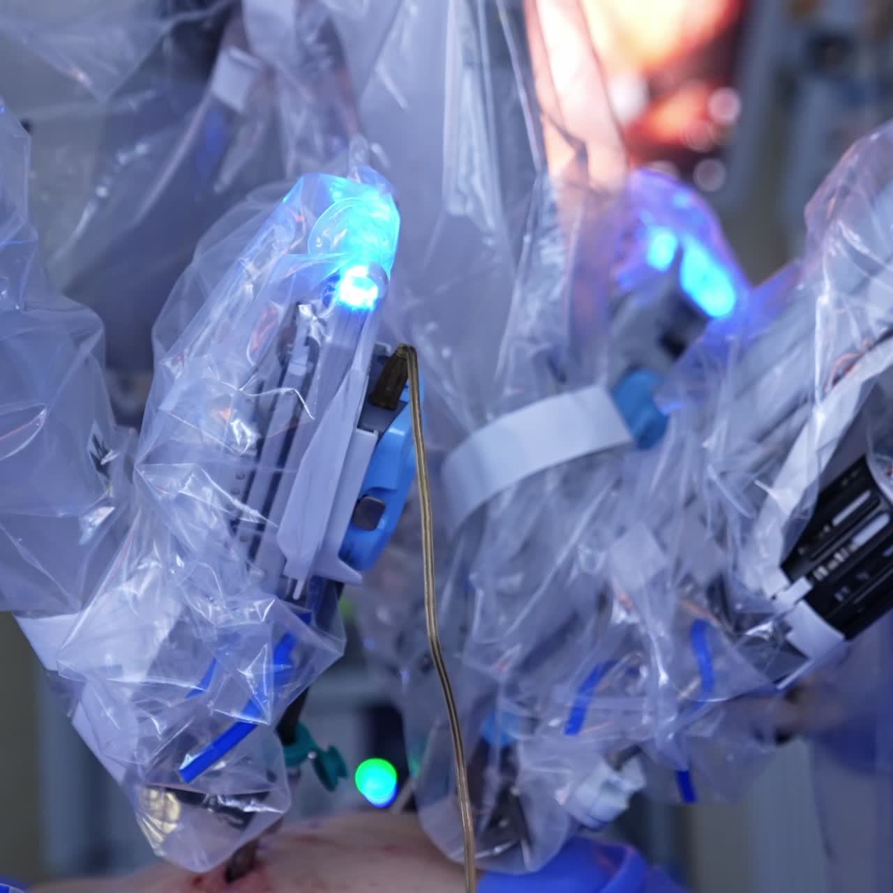 Arms of Da Vinci robot in plastic for sterility move in the operated abdomen. Unknown surgeon stands at backdrop in blur