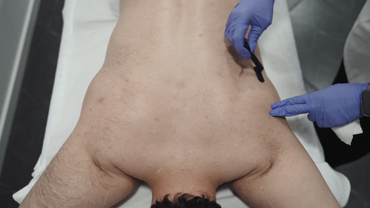 trabajo de afeitación pre-laser estratégico en el torso masculino - vista superior de cerca