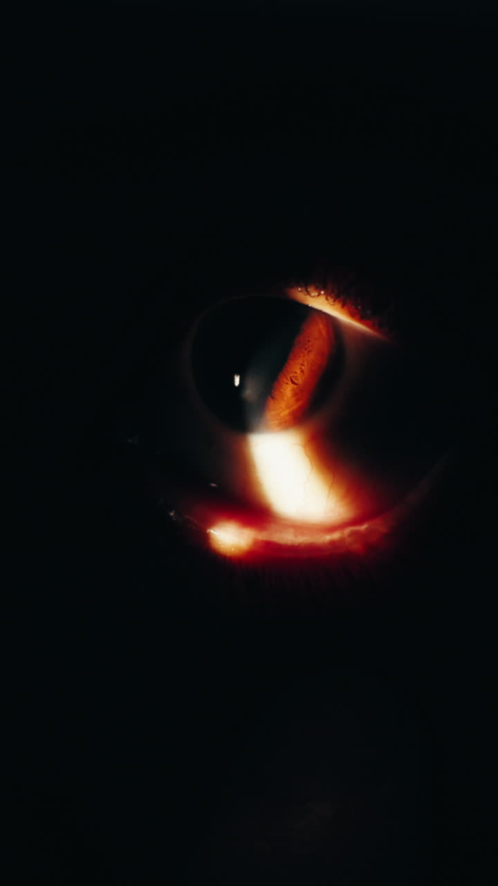 Eye Examination with Slit-Lamp