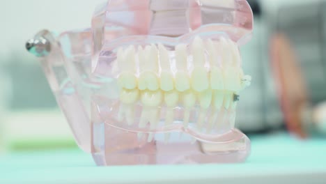 dental model