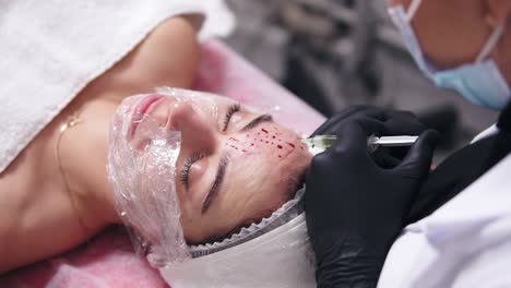 close up view of a professional cosmetologist in black gloves making multiple injections in woman's face skin during mesotherapy