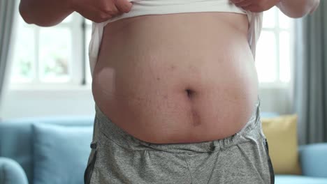 close-up view of a person with significant abdominal obesity.