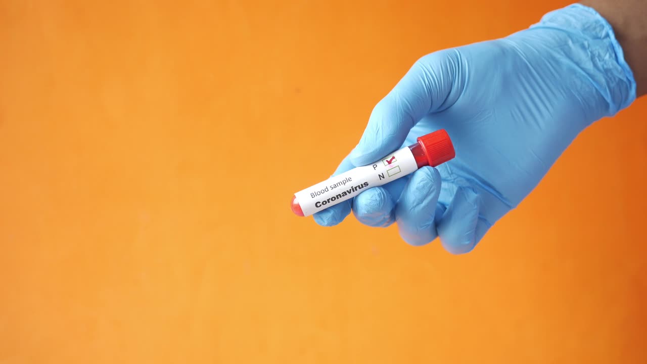 test del campione di sangue per il coronavirus