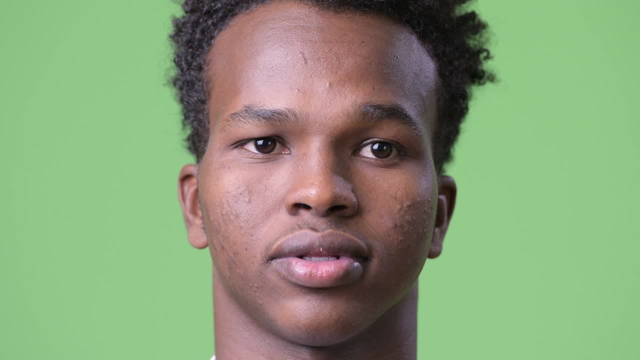 disparo en la cabeza de un joven africano