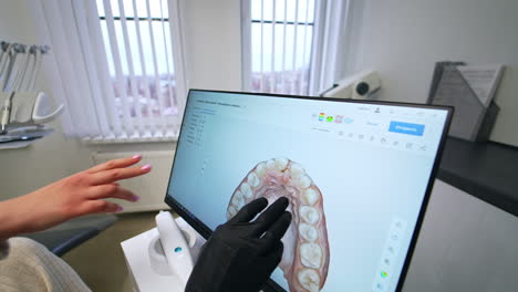 dentist's hand in latex black glove moving the 3d picture of patient's denture on the big sensor screen. doctor rotating the teeth projection to show the dental problems to a patient. close up.
