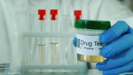 analysis of urine with a positive result for doping 1