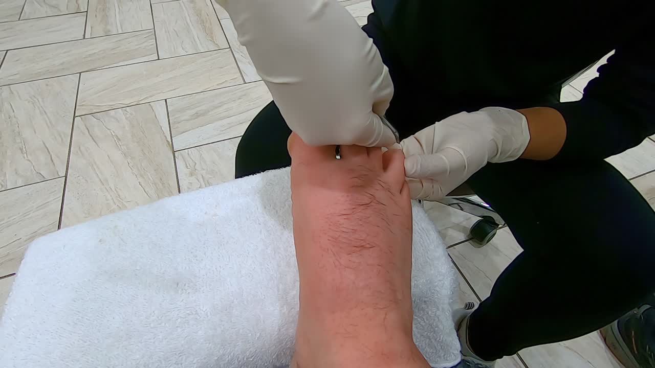 pedicurista profesional recorta las cutículas y la piel extra de los dedos cuarto y meñique derecho de un hombre usando pinzas para cutículas